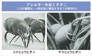 アレルギーを起こすダニの写真