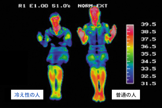 冷え性と普通の人の体温の差