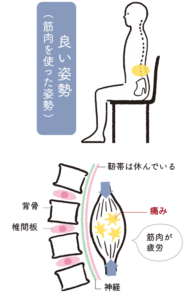 良い姿勢（筋肉を使った姿勢）背骨 椎間板 靭帯は休んでいる 痛み 筋肉が疲労 神経