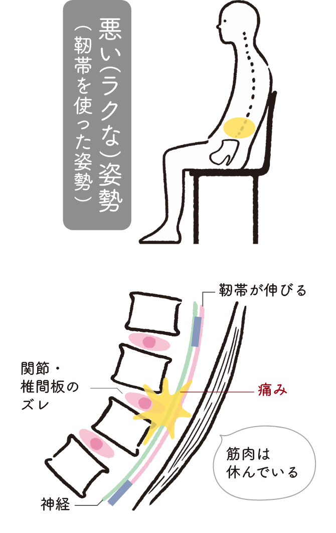 悪い（ラクな）姿勢（靭帯を使った姿勢） 関節・椎間板のズレ 靭帯が伸びる 痛み 神経 筋肉は休んでいる